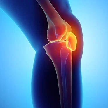 For Osteoarthritis of the peripheral joints